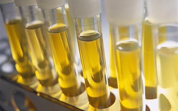 Edible Oil Analysis